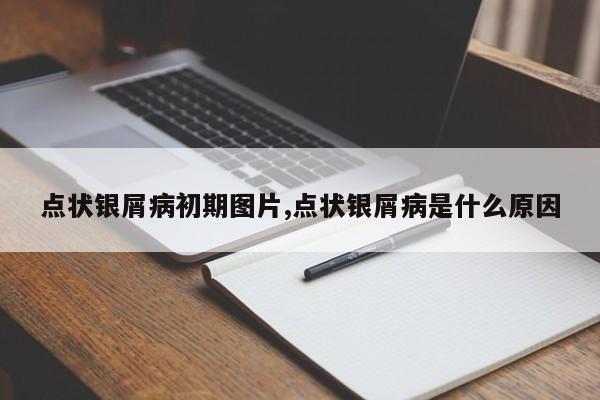 点状银屑病初期图片,点状银屑病是什么原因